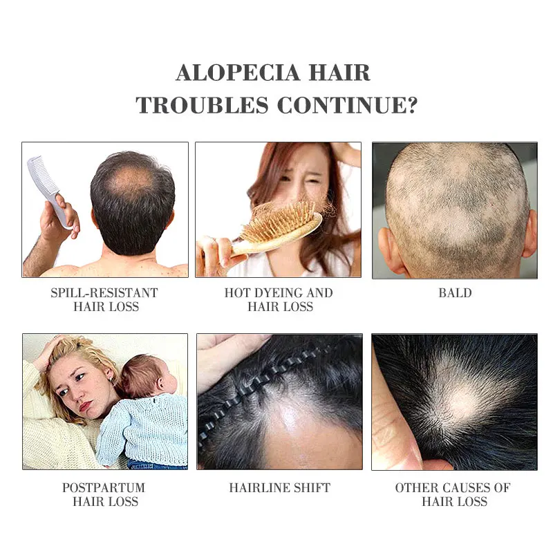 200 ml Professional Šampón Pre Anti-hair Loss Bylina Rýchly Rast Vlasov Produkt Zabrániť starostlivosť o Vlasy Pre Unisex toaletné Potreby
