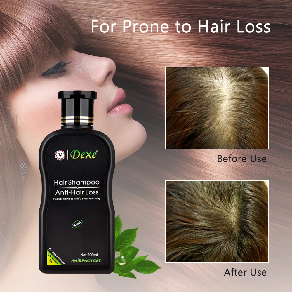 Anti-hair Loss Shampoo Odbornej Čínskej Bylinnej Rast Vlasov Liečba Vlasy Zabrániť Hrubé Výrobok pre Starostlivosť o Vlasy pre Dospelých 200 ml