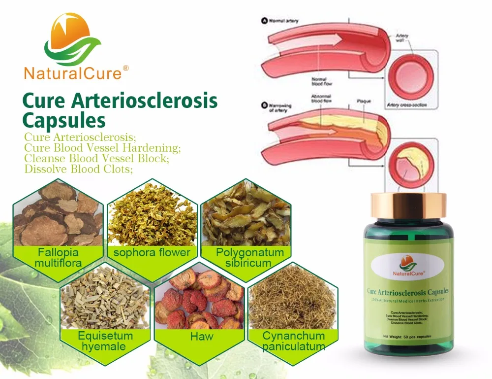 NaturalCure Liek proti ateroskleróze Kapsúl, Zvyšuje Pružnosť Cievnych, Čistí Cievy a Žily, Rastliny Extrakt 50 tabliet
