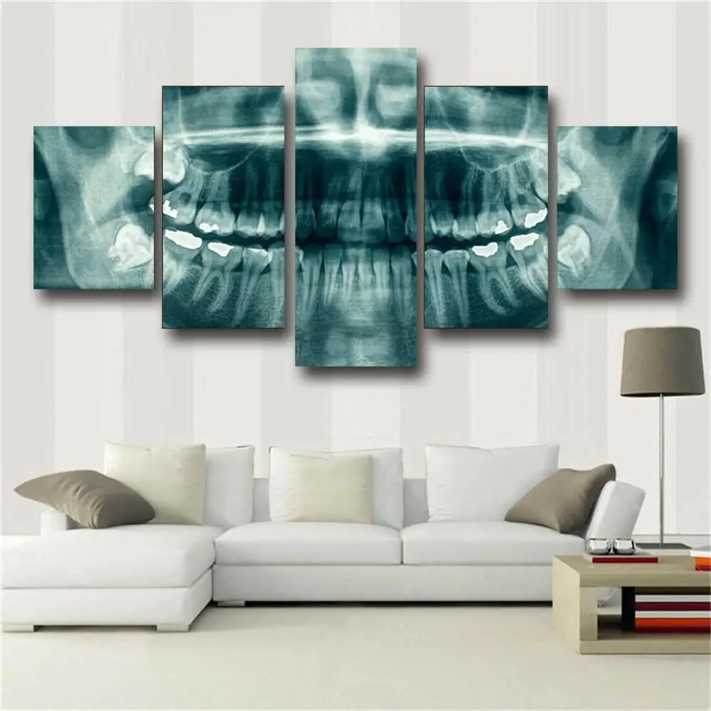 Wall Art Obrázky Domova Moderné HD Vytlačí 5 Panel Zubné Zuby X-ray Zubár Maľba Boh V koráne Plátno Plagát