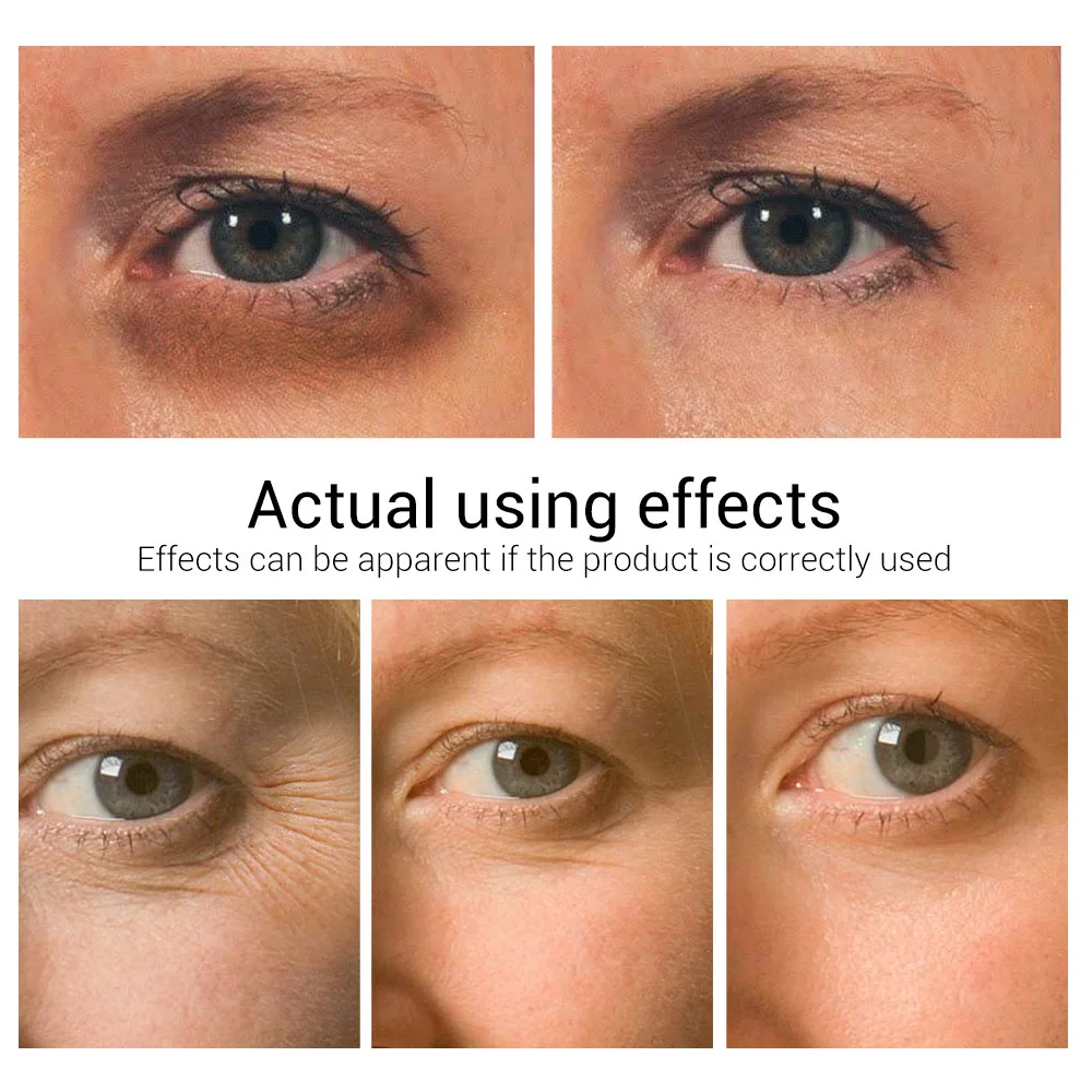 LANBENA Zubov Eye Cream Eye Serum Odstrániť temný Kruh Anti-aging Eye Opravy Zdvíhacích Anti-opuchy Spevnenie Starostlivosť o Oči