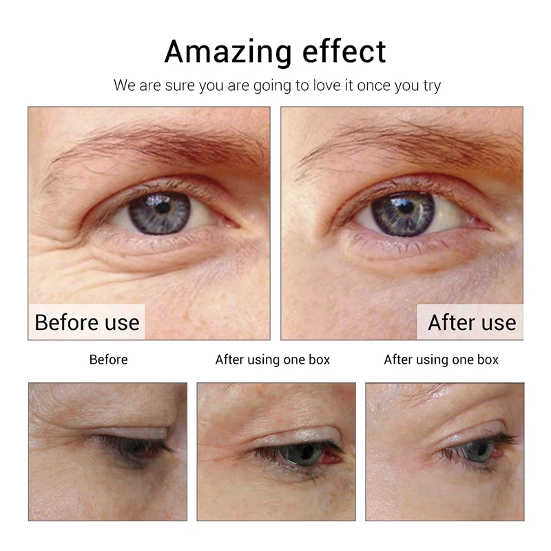 Očné Ošetrenie Kože Bieliace Sérum Čierne Kruhy Hydratačné Anti-wrinkle Odstránenie Opuchnuté Oko Podstate Vyživujú Oko Starostlivosti o Pleť 2KS