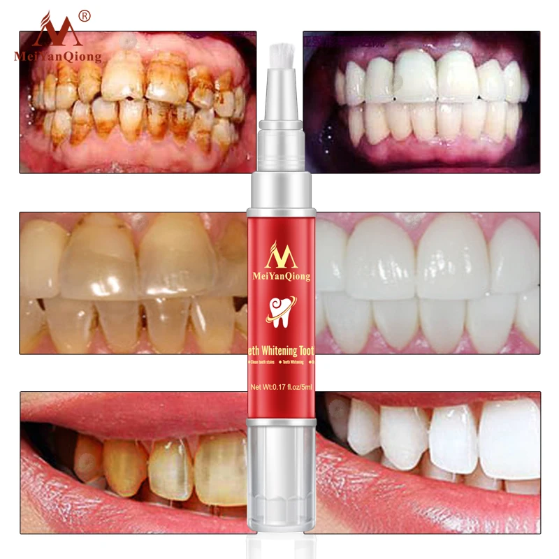 2 ks Bielenie Zubov Zubná Kefka Podstate Ústna Hygiena, Čistenie, Sérum, Odstraňuje Plak Škvrny Zubov Bielenie, Zubné Nástroje Zub