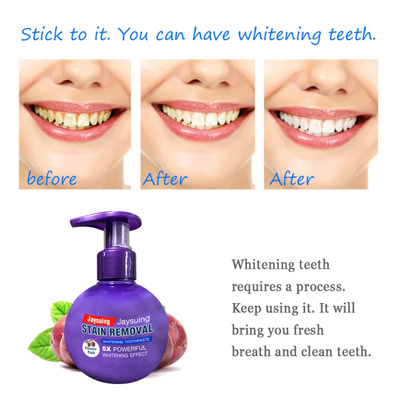 Intenzívne Stain Remover Whitening zubná pasta Proti Krvácanie Ďasien s zubná Kefka pre Čistenie Zubov Le dentifrice Dentifricio RT9