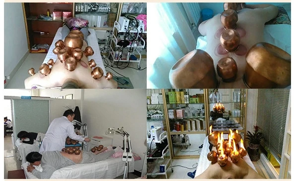 Mongolsko 9 Jar/Set Červená meď Čínskej Lekárskej Vákuové Telo masážneho Acupunture Bankovanie, Vákuové Prenosné Masážne Terapia, bankovanie
