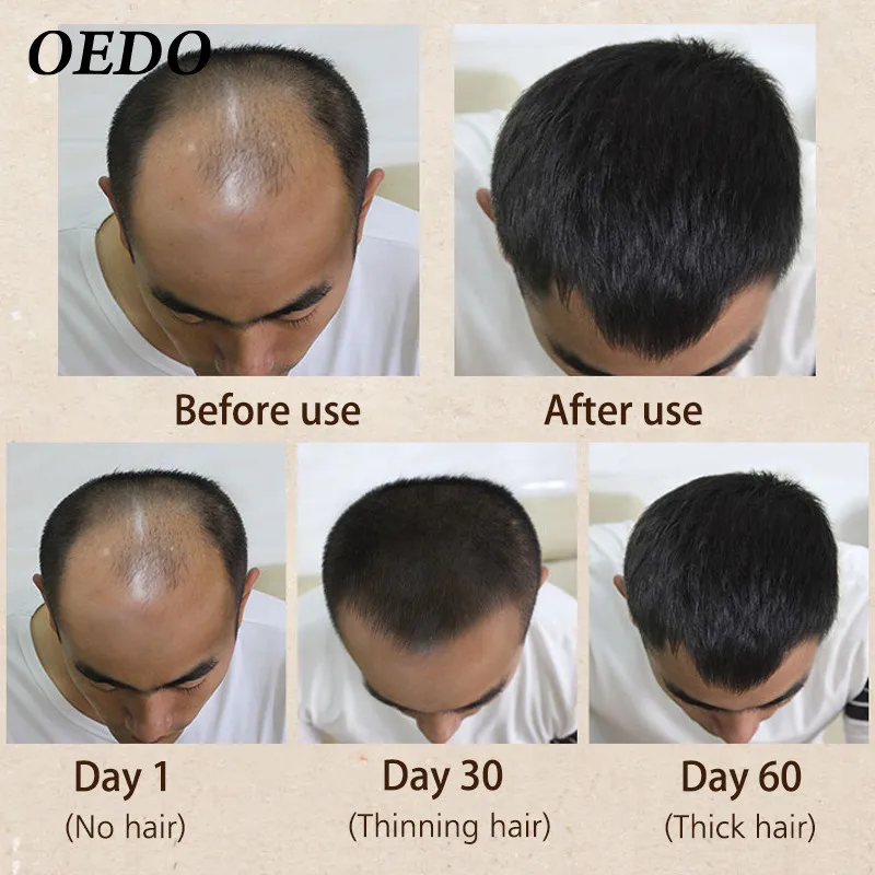Marocký Bylinné Ženšen Rast Vlasov Podstate Repair Cream Zabrániť Vypadávaniu Vlasov Produkt Opravy Kučeravé Suchú Pokožku Hlavy Starostlivosti Podstate