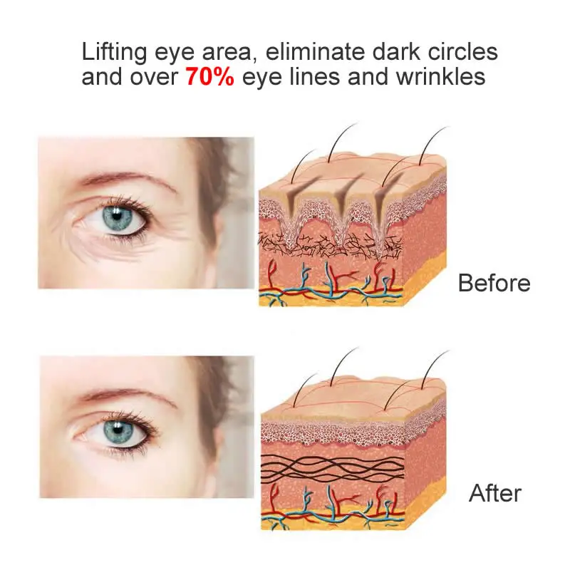Očné Ošetrenie Kože Bieliace Sérum Čierne Kruhy Hydratačné Anti-wrinkle Odstránenie Opuchnuté Oko Podstate Vyživujú Oko Starostlivosti o Pleť 2KS